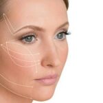 Aplicação de Bioestimulador Facial e Corporal